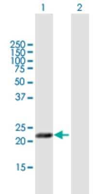 Western Blot: MAGP-2/MFAP5 Antibody [H00008076-B01P]