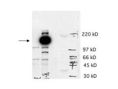 Western Blot: CASZ1 Antibody [NBP1-77942]