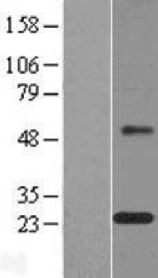 Western Blot: MAGP-1/MFAP2 Overexpression Lysate [NBL1-13032]