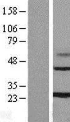 Western Blot: MAGP-1/MFAP2 Overexpression Lysate [NBL1-13033]