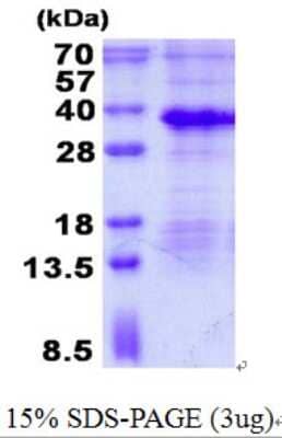 SDS-PAGE: Recombinant Human MAGP-1/MFAP2 His Protein [NBP2-23234]