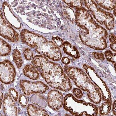 Immunohistochemistry-Paraffin: MAGT1 Antibody [NBP2-14214]