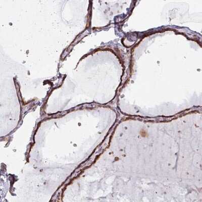 Immunohistochemistry-Paraffin: MAGT1 Antibody [NBP2-14214]