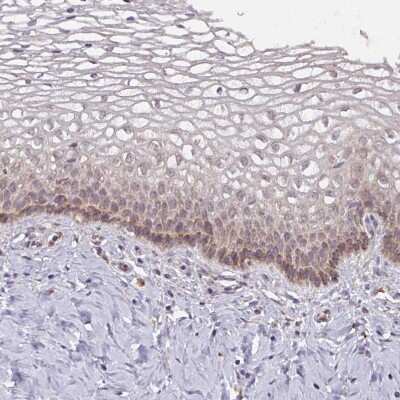 Immunohistochemistry-Paraffin: MAGT1 Antibody [NBP2-14214]