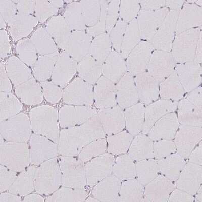 Immunohistochemistry-Paraffin: MAGT1 Antibody [NBP2-14214]