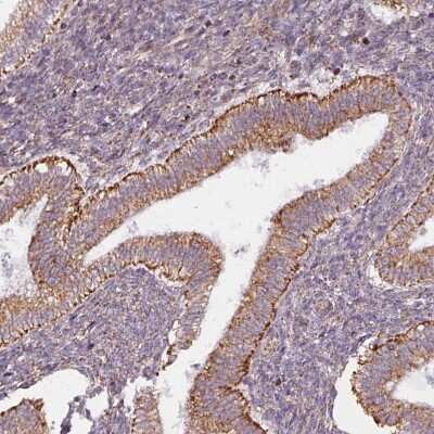 Immunohistochemistry-Paraffin: MAGT1 Antibody [NBP2-14214]