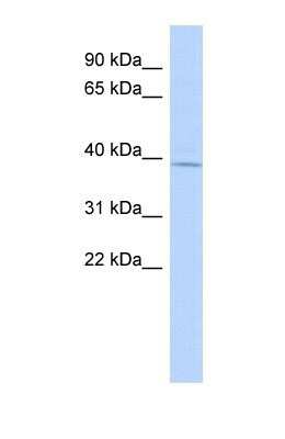 Western Blot: MAGT1 Antibody [NBP1-69683]