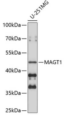 Western Blot: MAGT1 AntibodyBSA Free [NBP3-05125]