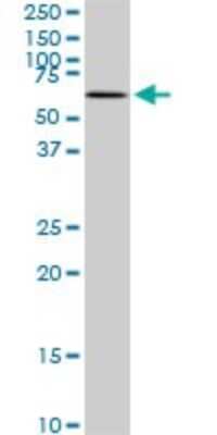 Western Blot: MAK Antibody (3E5) [H00004117-M01]