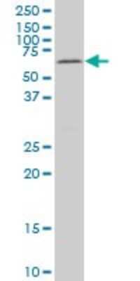Western Blot: MAK Antibody (3E5) [H00004117-M01]
