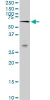 Western Blot: MAK Antibody (3E5) [H00004117-M01]