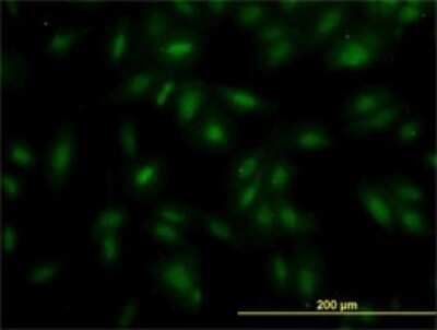 Immunocytochemistry/ Immunofluorescence: MAK Antibody (4E9) [H00004117-M02]