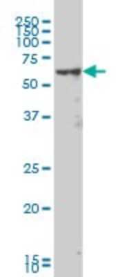 Western Blot: MAK Antibody (4E9) [H00004117-M02]