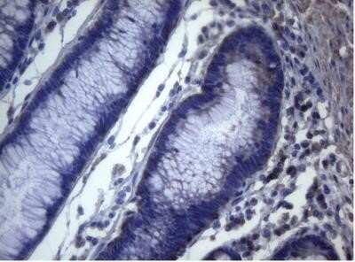 Immunohistochemistry: MAK Antibody (OTI5A7) - Azide and BSA Free [NBP2-72580]