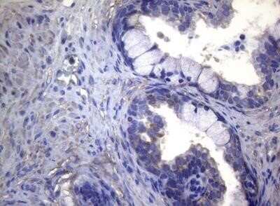 Immunohistochemistry: MAK Antibody (OTI5A7) - Azide and BSA Free [NBP2-72580]