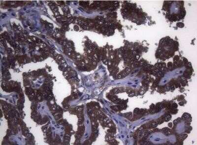 Immunohistochemistry: MAK Antibody (OTI5A7) - Azide and BSA Free [NBP2-72580]