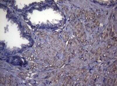 Immunohistochemistry: MAK Antibody (OTI5A7) - Azide and BSA Free [NBP2-72580]