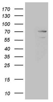 Western Blot: MAK Antibody (OTI5A7)Azide and BSA Free [NBP2-72580]