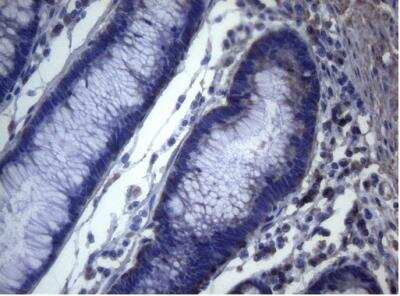 Immunohistochemistry-Paraffin: MAK Antibody (OTI5A7) [NBP2-45723]