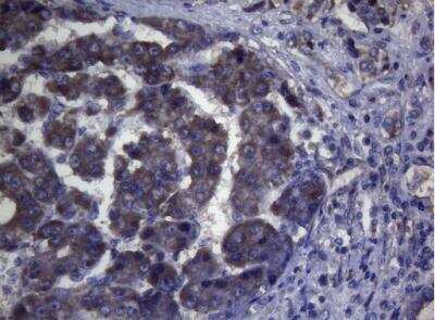 Immunohistochemistry-Paraffin: MAK Antibody (OTI5A7) [NBP2-45723]