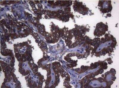 Immunohistochemistry-Paraffin: MAK Antibody (OTI5A7) [NBP2-45723]
