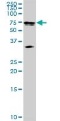 Western Blot: MAK Antibody [H00004117-D01P]