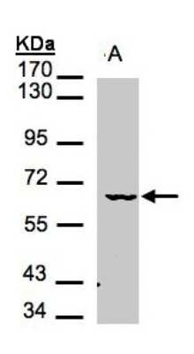 Western Blot: MAK Antibody [NBP1-32344]