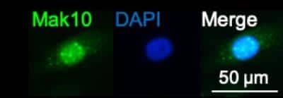 Immunocytochemistry/ Immunofluorescence: MAK10 Antibody [NBP2-58424]