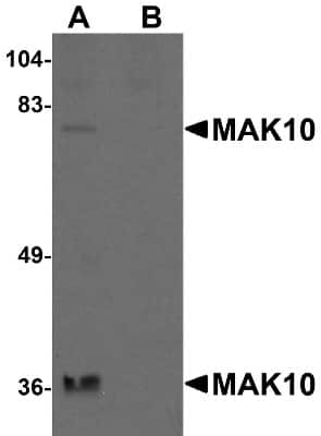 Western Blot: MAK10 AntibodyBSA Free [NBP1-77056]