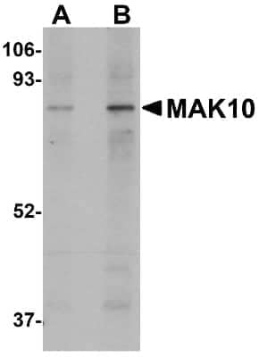 Western Blot: MAK10 AntibodyBSA Free [NBP1-77057]