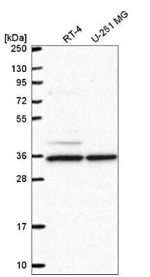 Western Blot: MAK10 Antibody [NBP2-58424]