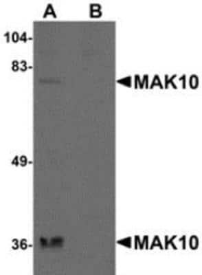 Western Blot: MAK10 Antibody Blocking Peptide [NBP1-77056PEP]