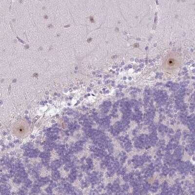 Immunohistochemistry: MAK16 Antibody [NBP2-47309]