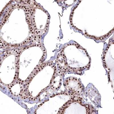 Immunohistochemistry-Paraffin: MAK16 Antibody [NBP2-47385]