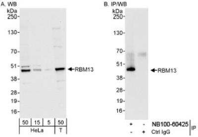 Western Blot: MAK16 Antibody [NB100-60425]