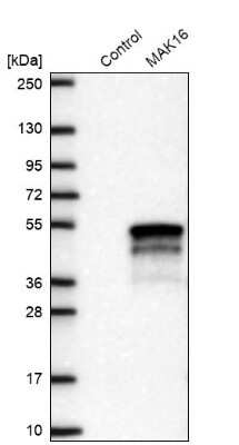 Western Blot: MAK16 Antibody [NBP2-47309]