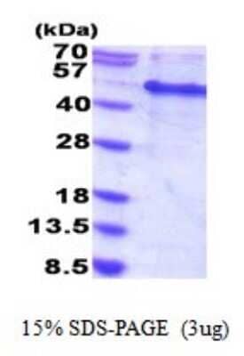 SDS-PAGE: Recombinant Human MAK16 His Protein [NBP2-51832]