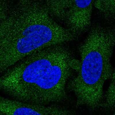 Immunocytochemistry/ Immunofluorescence: MAK3 Antibody [NBP2-31696]