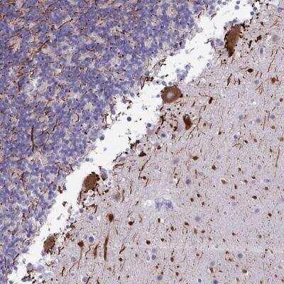 Immunohistochemistry-Paraffin: MAK3 Antibody [NBP2-31696]