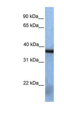 Western Blot: MAK3 Antibody [NBP1-70631]