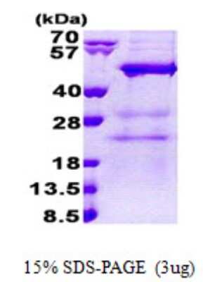 SDS-PAGE: Recombinant Human MAK3 His Protein [NBP2-23257]