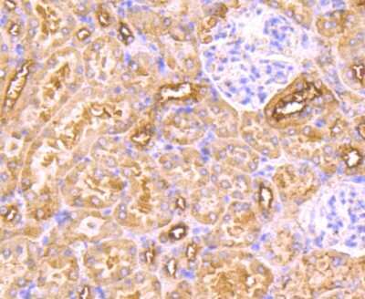 Immunohistochemistry-Paraffin: MAL Antibody (B5-G3) [NBP2-75563]