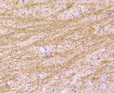 Immunohistochemistry-Paraffin: MAL Antibody (B5-G3) [NBP2-75563]