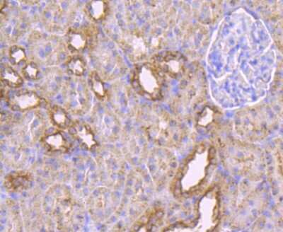 Immunohistochemistry-Paraffin: MAL Antibody (B5-G3) [NBP2-75563]