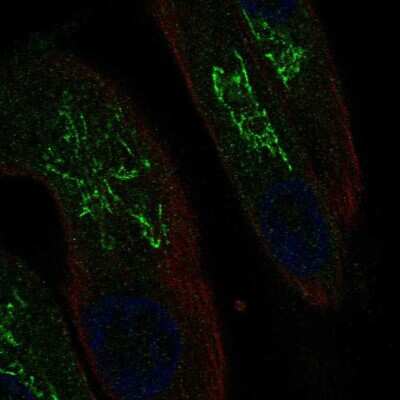 Immunocytochemistry/ Immunofluorescence: MAL Antibody [NBP2-55997]