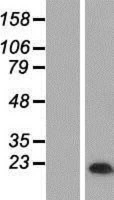 Western Blot: MAL Overexpression Lysate [NBP2-09899]