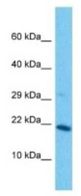 Western Blot: MAL2 Antibody [NBP3-10113]