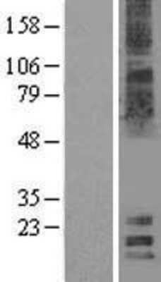 Western Blot: MAL2 Overexpression Lysate [NBL1-12830]