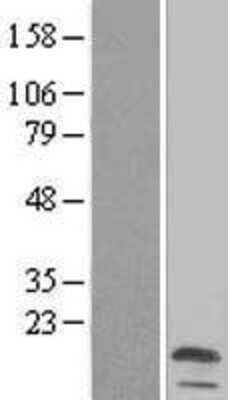 Western Blot: MALL Overexpression Lysate [NBL1-12831]