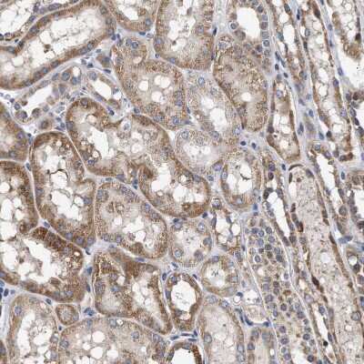 Immunohistochemistry-Paraffin: MALSU1 Antibody [NBP1-86026]